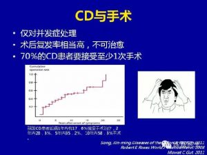 造口在克罗恩病中的应用-适应症与回纳时机