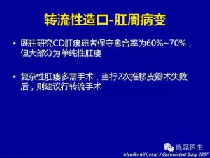 造口在克罗恩病中的应用-适应症与回纳时机