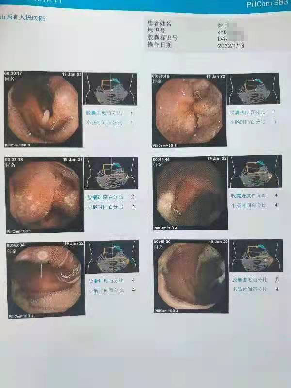 山西省人民医院秦某某