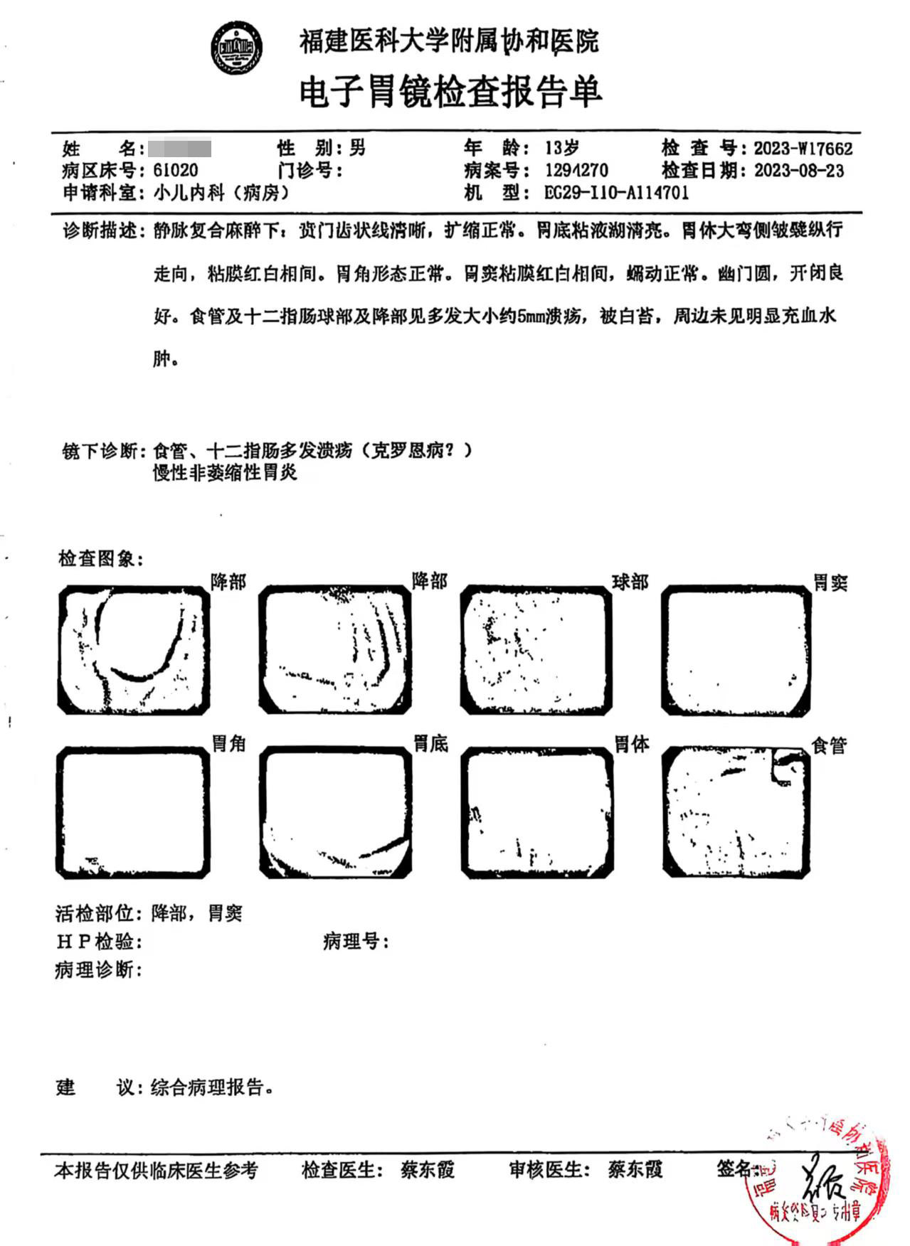 025年度治疗少年克罗恩病友案例(02)"