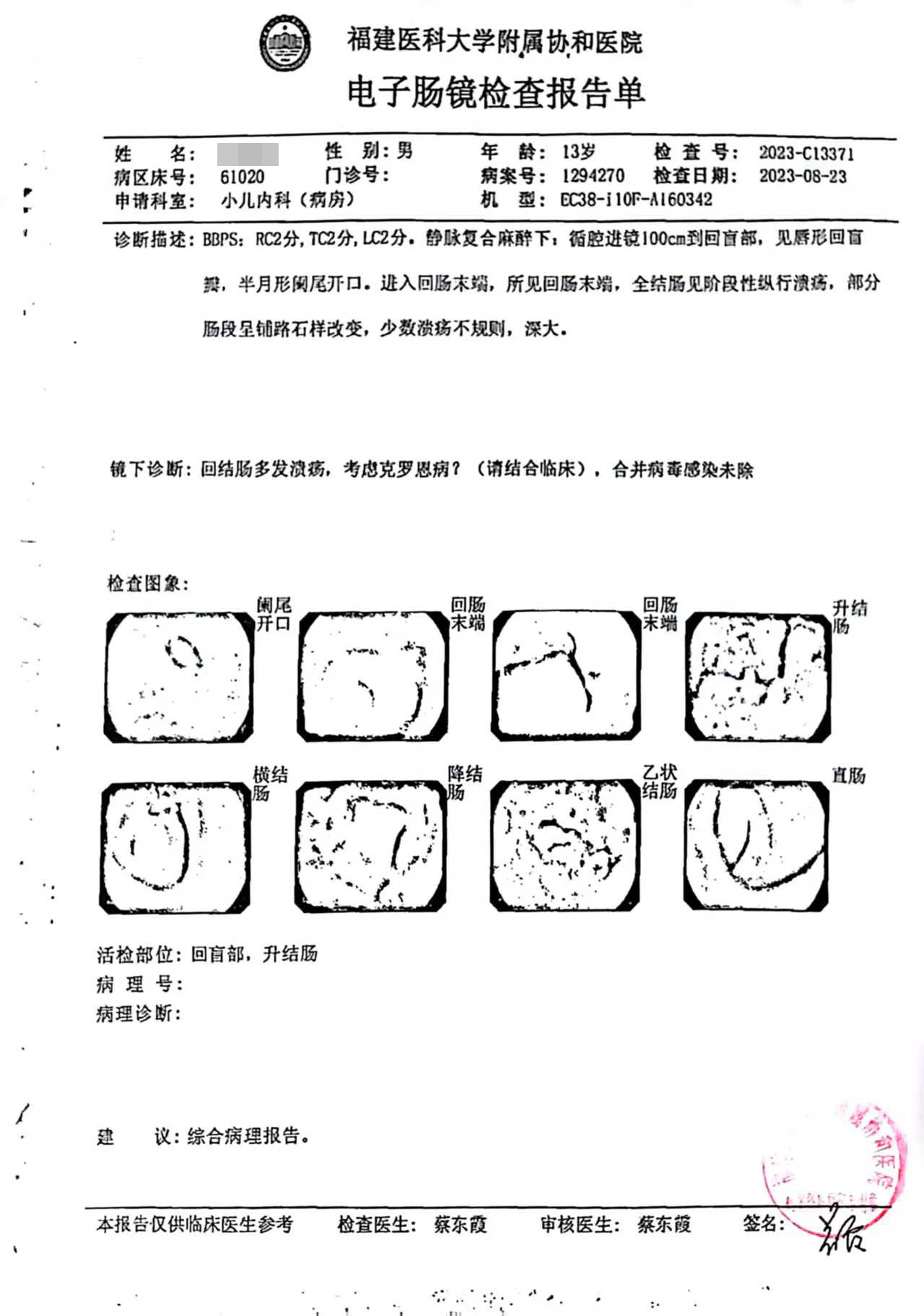 025年度治疗少年克罗恩病友案例(02)"