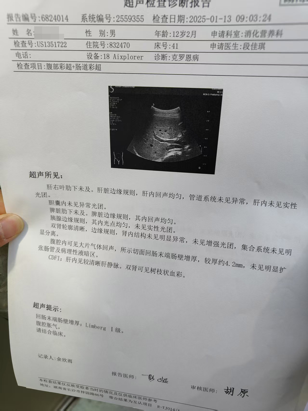 025年度治疗少年克罗恩病友案例(03)"