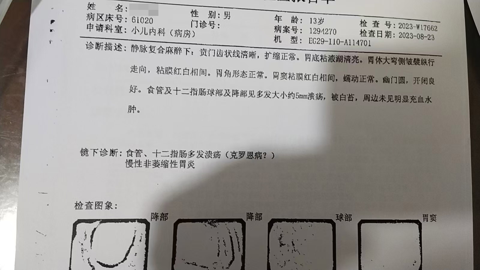 025年度治疗少年克罗恩病友案例(02)"