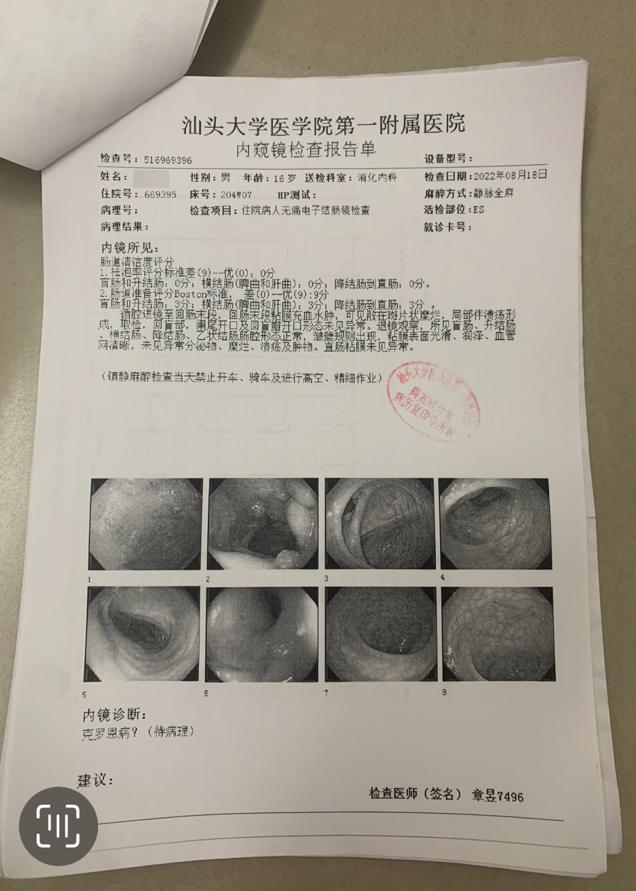 025年度治疗少年克罗恩病友案例(04)"