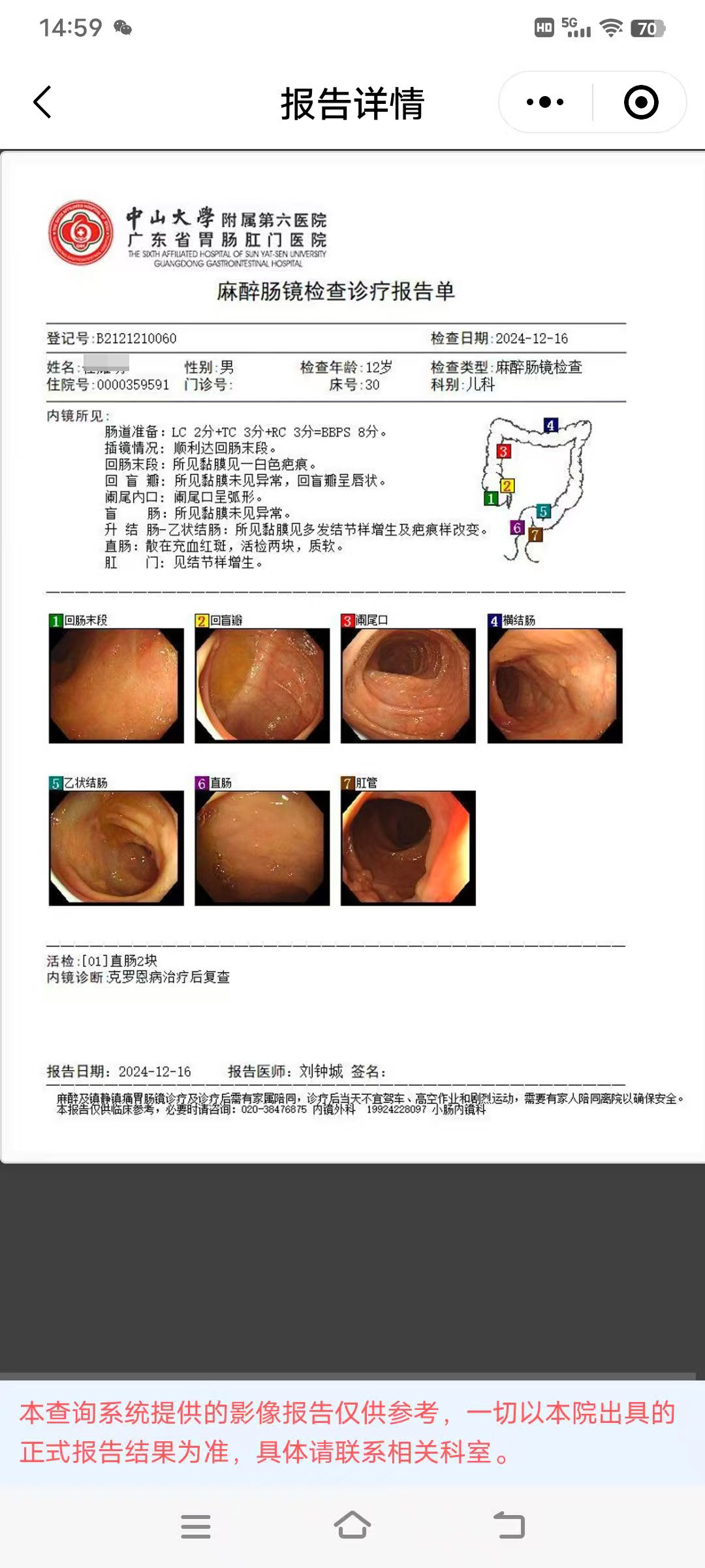 025年度治疗少年克罗恩病友案例(04)"